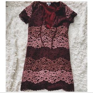 Tobi Lace Dress